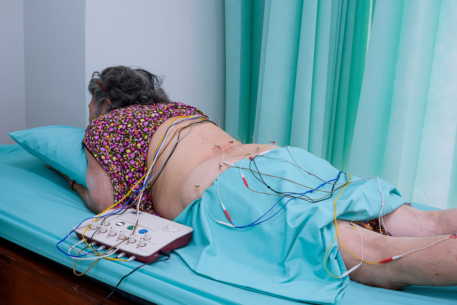 Neuropathy Treatment Unraveled: Embracing the Healing World of mHBOT