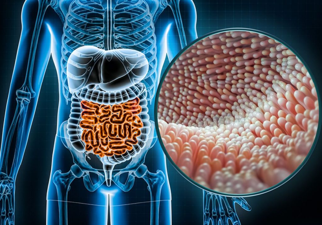 Inflamatory bowel disease
